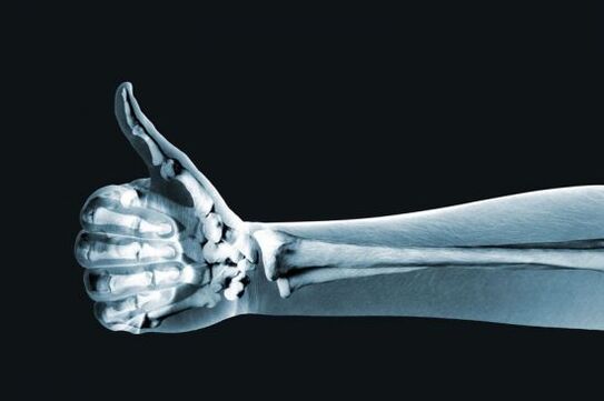 Raggi X utilizzati per diagnosticare il dolore alle articolazioni delle dita