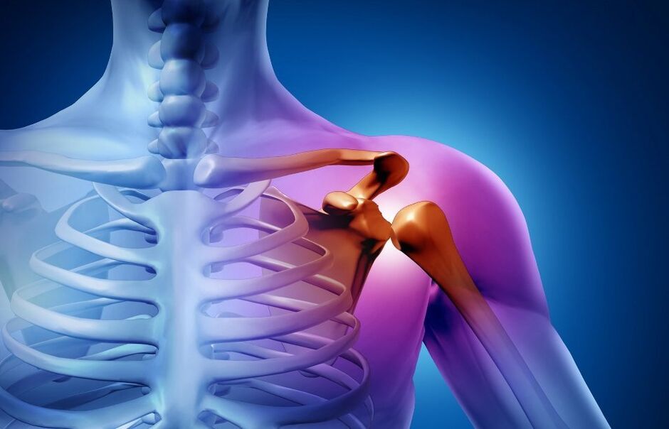 Lesione dell'articolazione della spalla a causa dell'artrosi