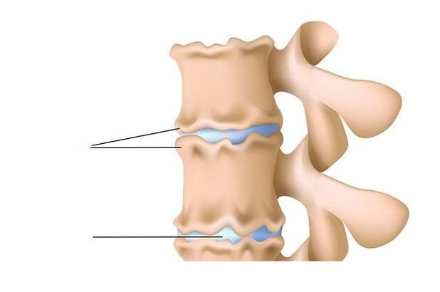 Lesione alla colonna vertebrale