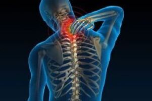 L'osteocondosi cervicale porta al dolore al collo