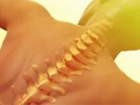 Osteocondrosi - Malattia della colonna vertebrale